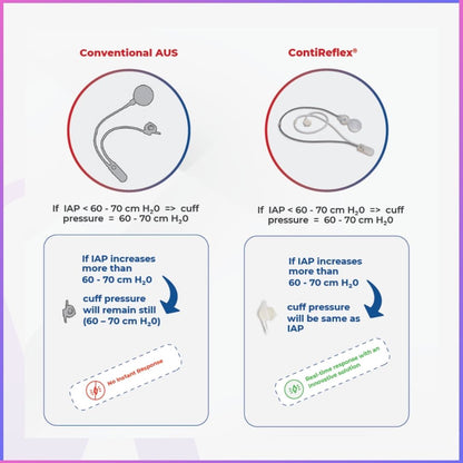 ContiReflex® Enhanced Artificial Urinary Sphincter